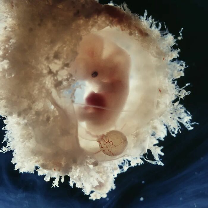 19 Groundbreaking Images By This Photographer Offering A Glimpse Into The Miracle Of Birth