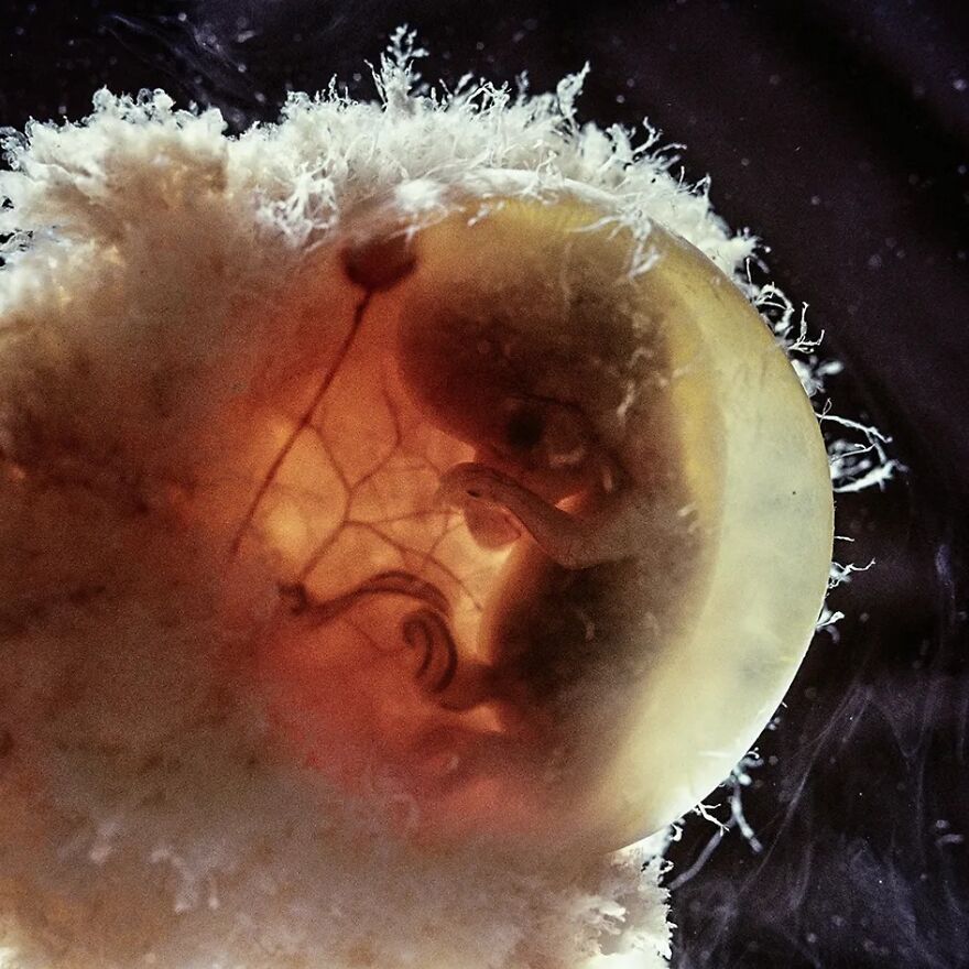 Meet Lennart Nilsson, The Photographer Who Spent 12 Years Photographing The Development Of Fetuses