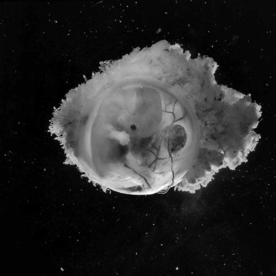 Meet Lennart Nilsson, The Photographer Who Spent 12 Years Photographing The Development Of Fetuses