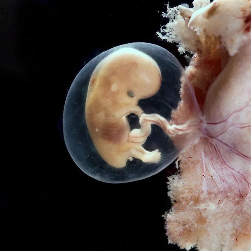 2 Months And 1 Week, 4 Cm, From The Series "A Child Is Born", 1965