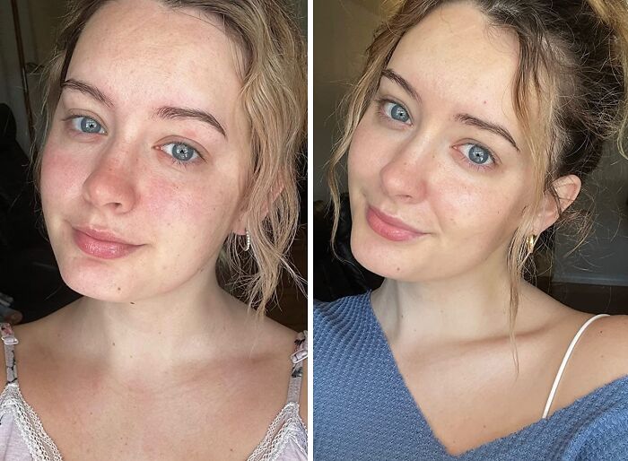 Revitalize Your Gaze With Roc Retinol Correxion Eye Cream : The Transformative Elixir For Ageless Radiance, Combating Fine Lines And Tired Eyes With Every Application