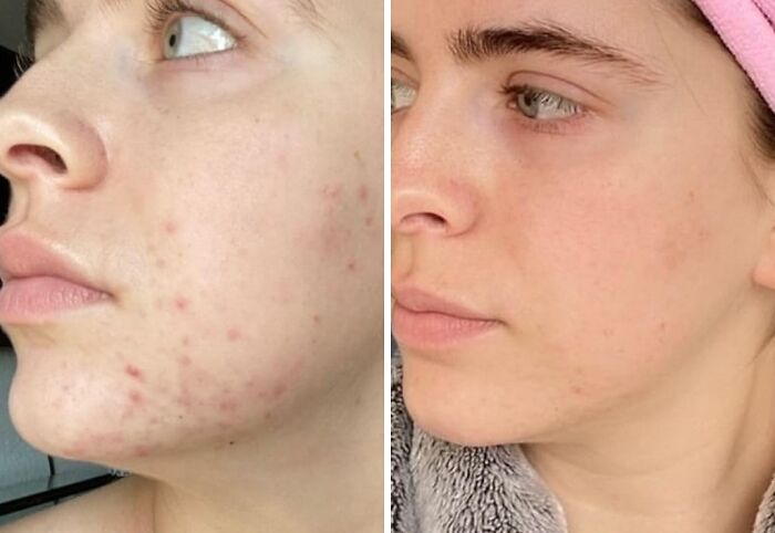 Fresh Face, No Trace With Clean Skin Club Towels - Softness Unleashed!