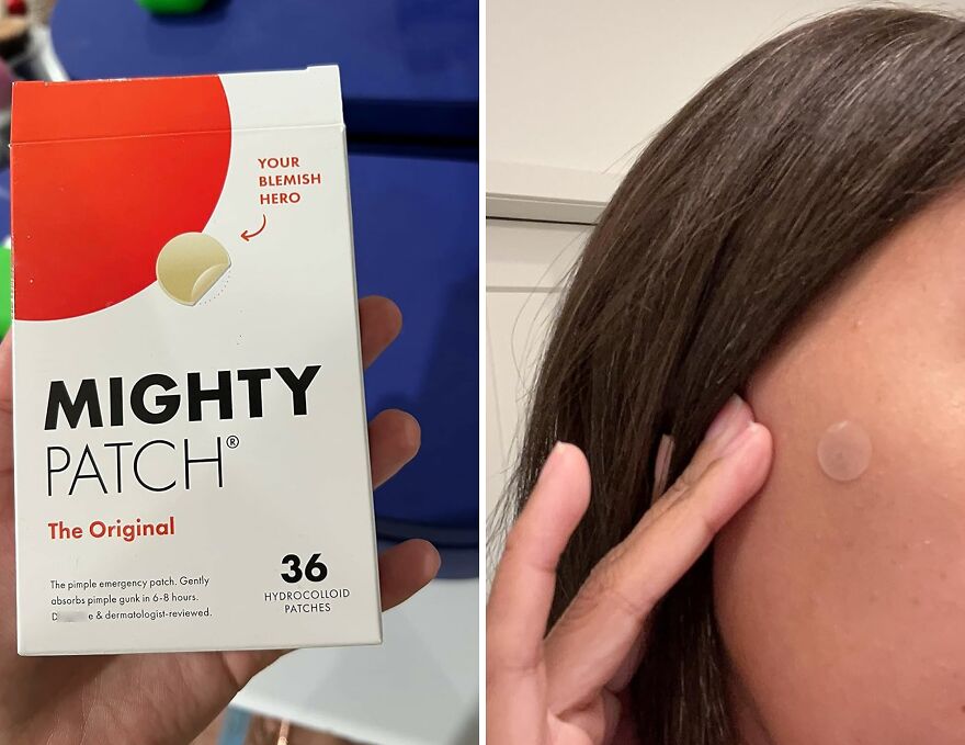 Achieve Clear, Blemish-Free Skin With Must Have Acne Pimple Patches 