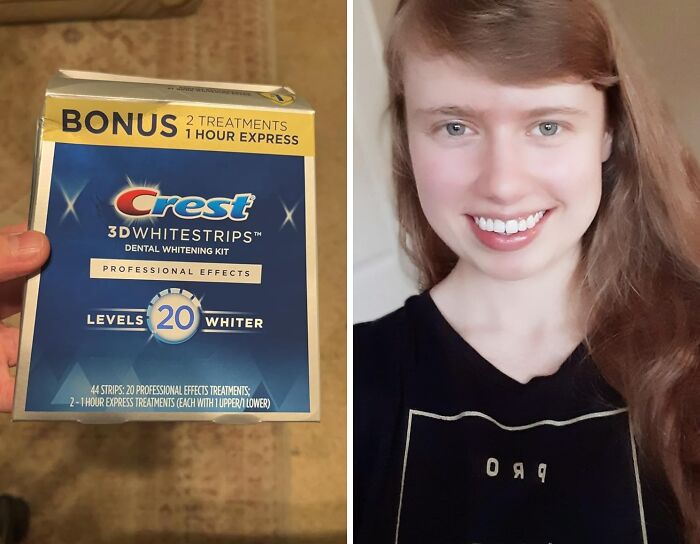 Get Your Brightest Smile With Crest 3D Whitestrips: Effortlessly Achieve Whiter Teeth At Home