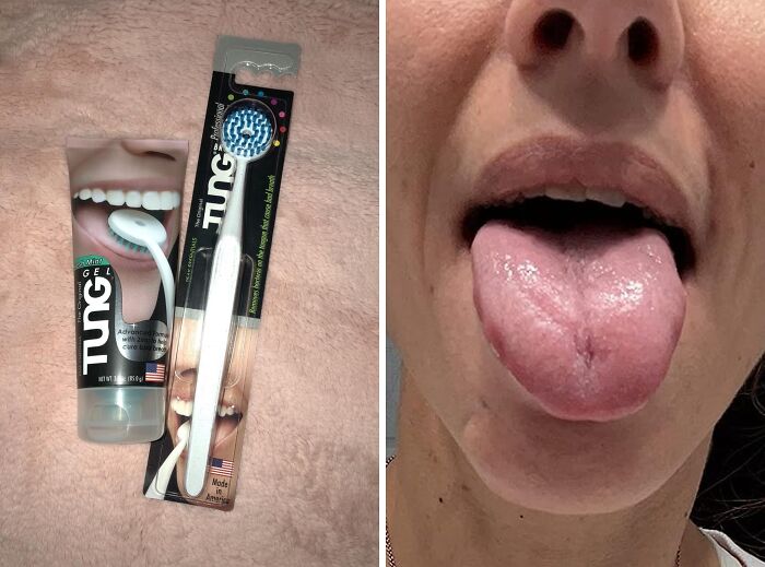 Freshen Your Breath With Tung Tongue Brush & Gel Kit: Complete Oral Care For A Healthy Mouth