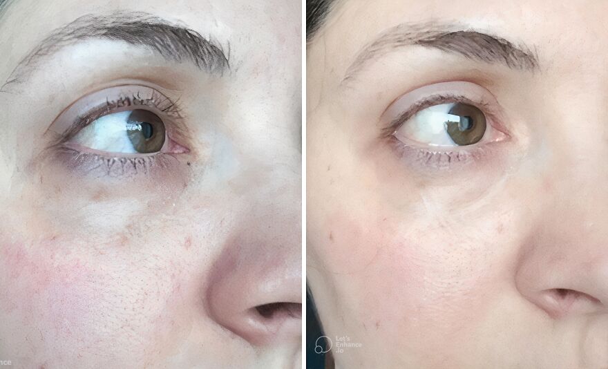 Ditch The Dark Circles: Grace & Stella's Gel Eye Patches To The Rescue!