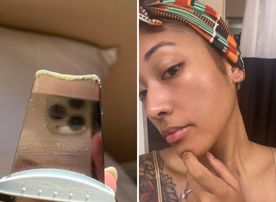 Blackhead Banisher: Gugug’s Gentle Touch For Pure Pores!