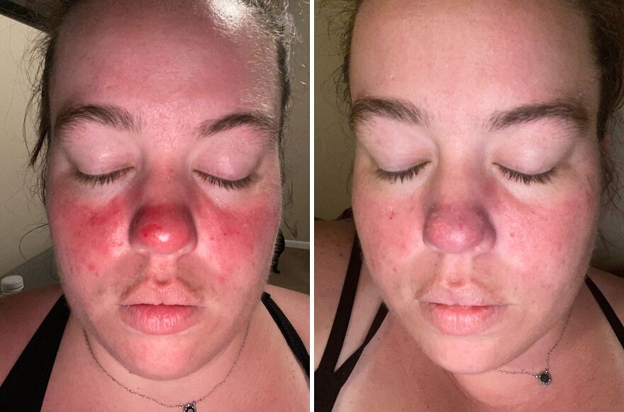 Soothe & Calm Your Skin: Dearklairs Midnight Blue Cream For Redness Relief!