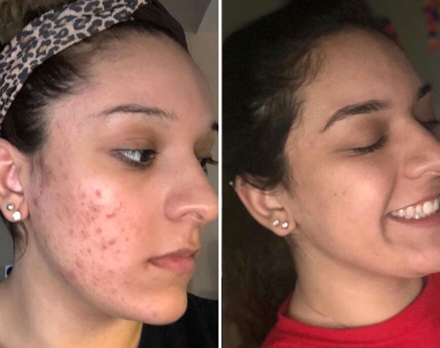 Cleanse & Care: Cerave’s Moisturizing Wash For Refreshed, Hydrated Skin!