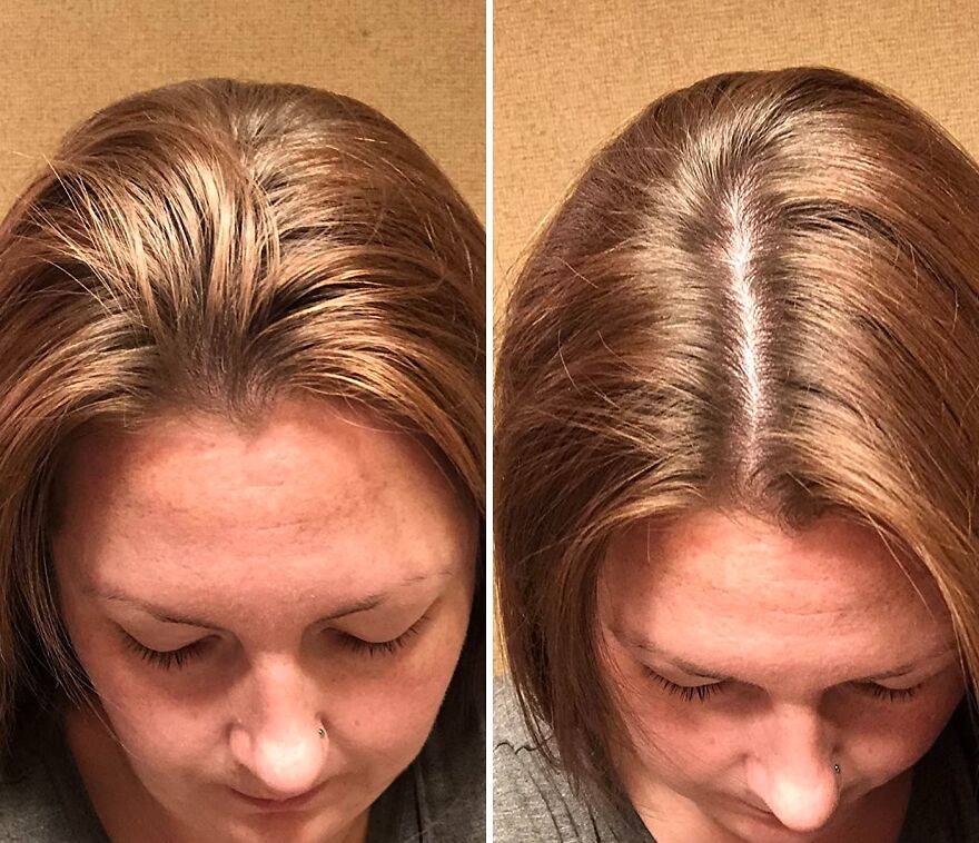 From Flat To Fab: Handmade Heroes Dry Shampoo For Instant Freshness!