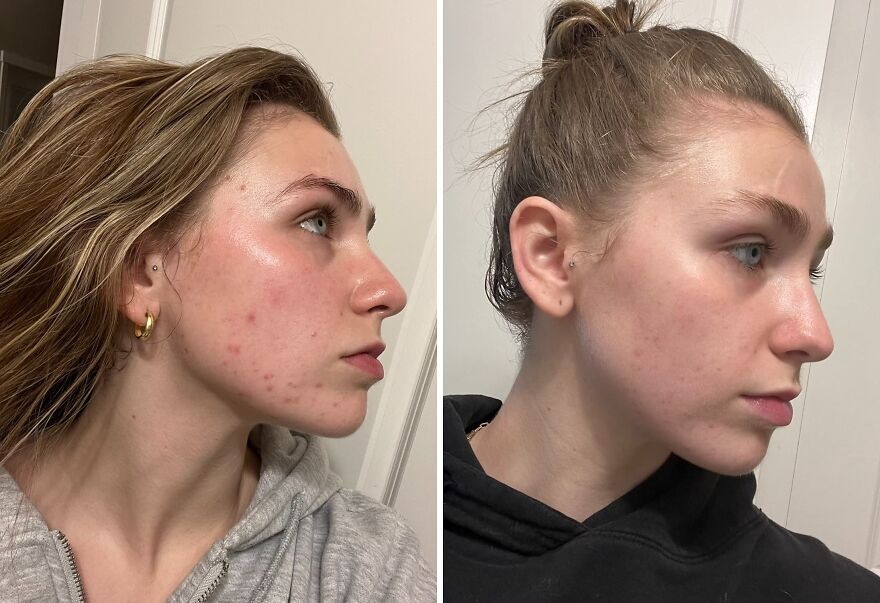 Smooth, Brighten, Refine: Cerave's Serum Tackles Textures & Pores!