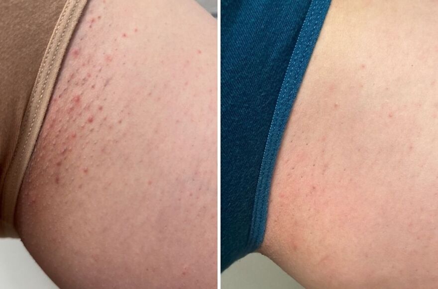 Smooth Sailing: Bushbalm Oil For Your Best Skin, Bye Ingrowns & Redness!