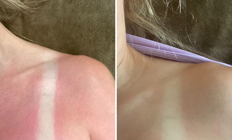 Soothe Your Sun-Kissed Skin With Solar Recover's Hydrating Spray!