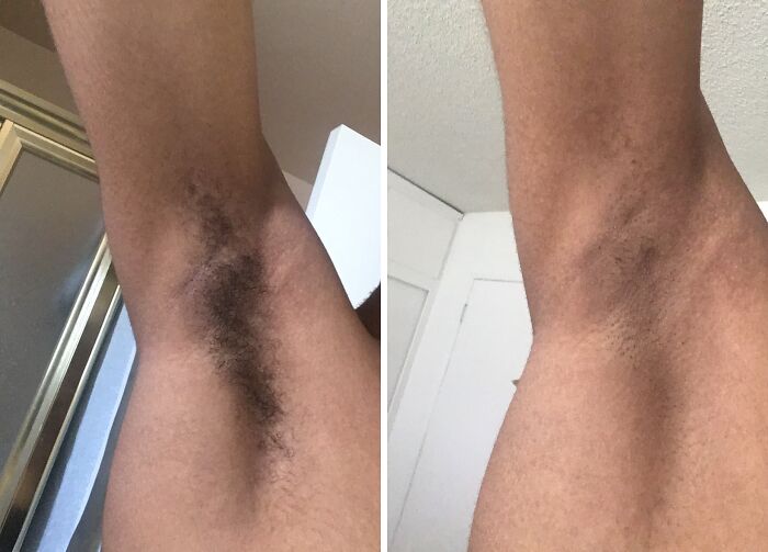 Gentle & Effective: Veet’s Removal Cream For Sensitively Smooth Skin!