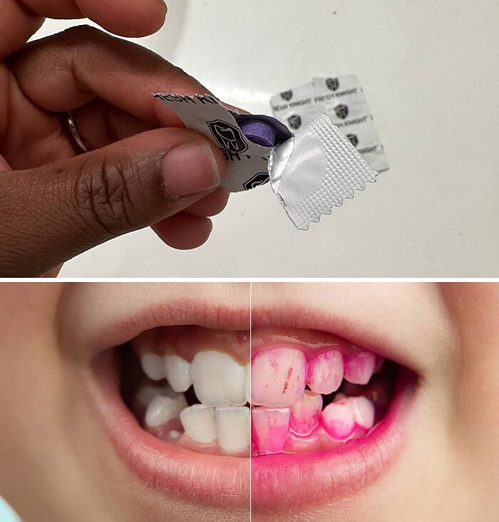 Tooth Truths Unveiled: Fresh Knight’s Plaque Reveal