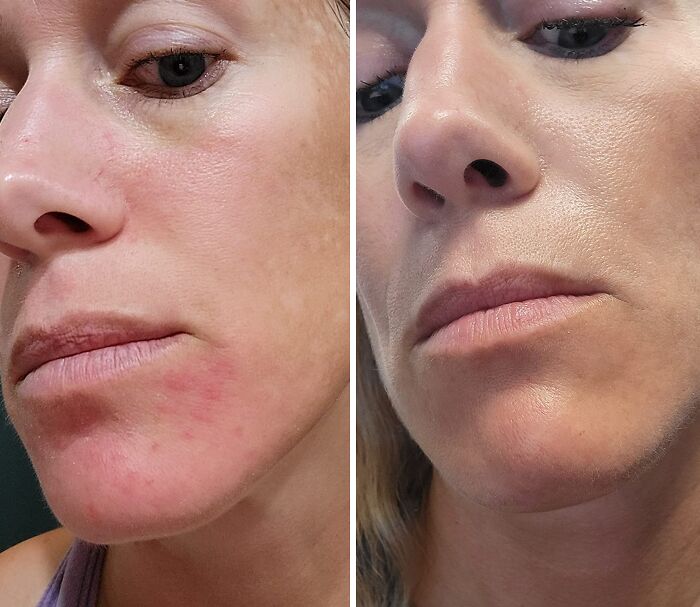 Silky Smooth Secret: Toleriane’s Fragrance-Free Formula