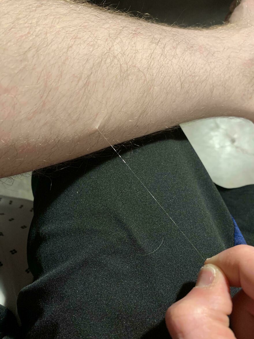 My Single Extremely Long Leg Hair