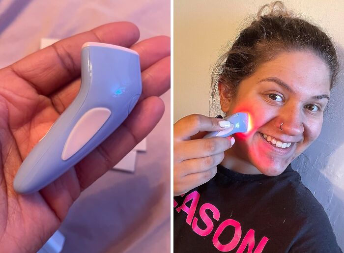 Say Farewell To Blemishes With Solawave Bye Acne Spot Treatment