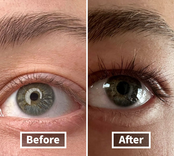 Bat Those Lashes: Grandelash-Md Serum For Grande Cosmetics’ Longest Look!