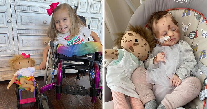 Woman Creates Inclusive Dolls Representing Their Owners That Face Rare Health Conditions (30 Pics)