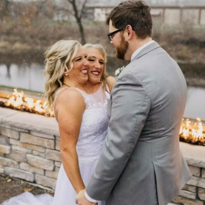 Dicephalus-Conjoined Twin Abby Hensel Of &ldquo;Abby & Brittany&rdquo; Is Married