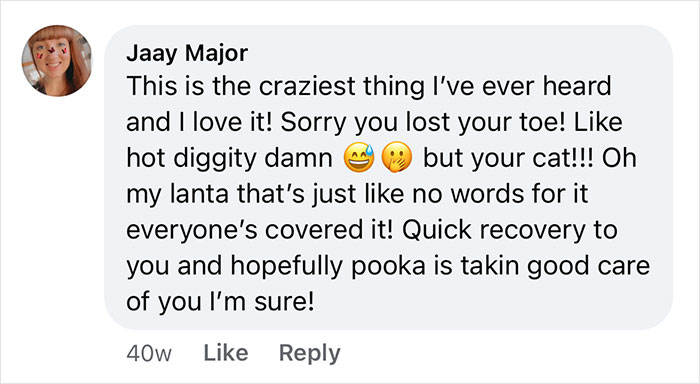 Woman Says The Bond With Her Cat Was Strengthened After The Cat Sneakily Consumed Her Toe