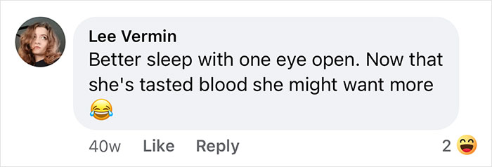 Woman Says The Bond With Her Cat Was Strengthened After The Cat Sneakily Consumed Her Toe