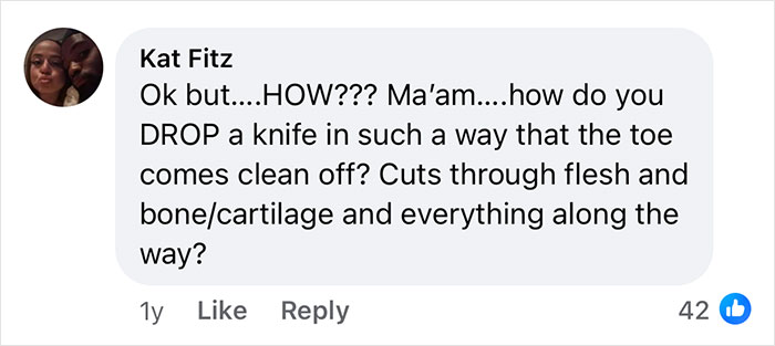 Woman Says The Bond With Her Cat Was Strengthened After The Cat Sneakily Consumed Her Toe