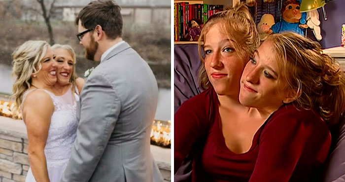 Conjoined Twins Brittany and Abby Fire Back At Negative Comments On Abby’s Marriage To Josh