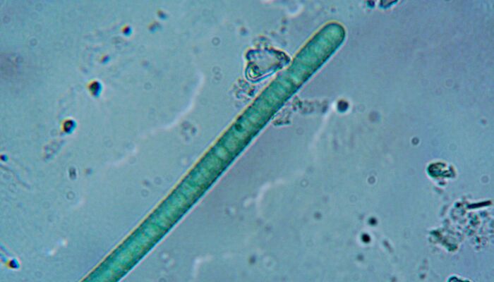 Worms Living In Chernobyl Exclusion Zone Have Super Ability That Humans Don’t Have