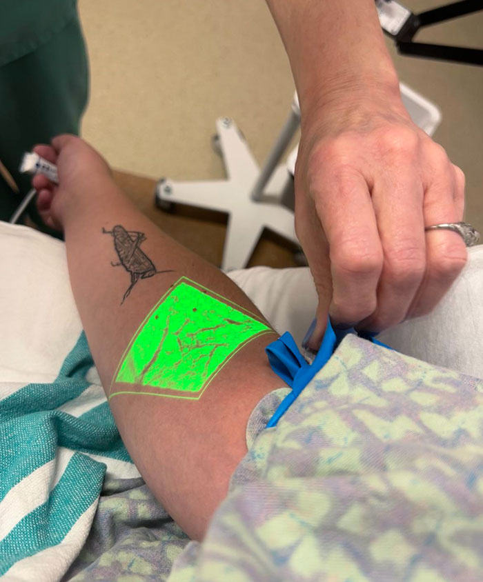 After 3 Minutes In The Tourniquet, She Decided I Should Be The First Patient To Test Out The Vein Scanner My Hospital Bought Today. Here Are My Insides