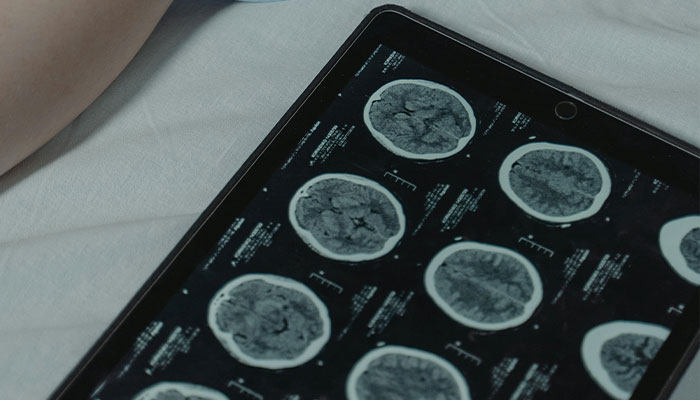 Man&rsquo;s Habit Of Eating &ldquo;Lightly Cooked&rdquo; Bacon Likely Led To Tapeworm Infection, Doctors Say