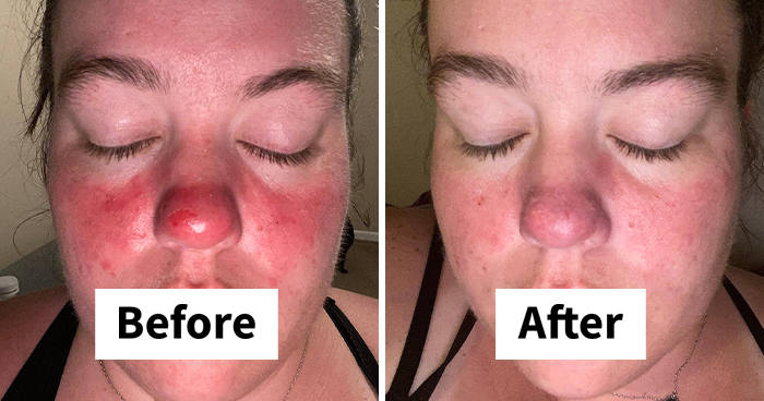 33 Korean Skincare Investments for Healthy, Radiant Skin