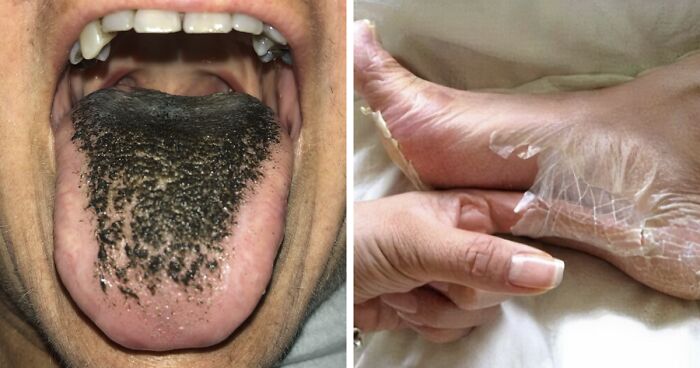 50 Times People Came Across Something ‘Mildly Disgusting’ And Had To Share In This Group