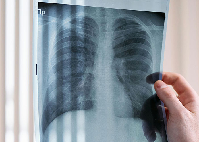 35 Things People Assumed Were Normal About Their Bodies Until Someone Pointed Out Otherwise - 17