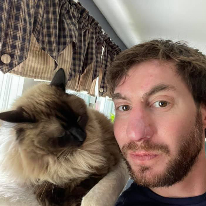 Before And After Of Man Who Received &ldquo;Amazing&rdquo; Nasal Reconstruction After Getting Mauled By Dog