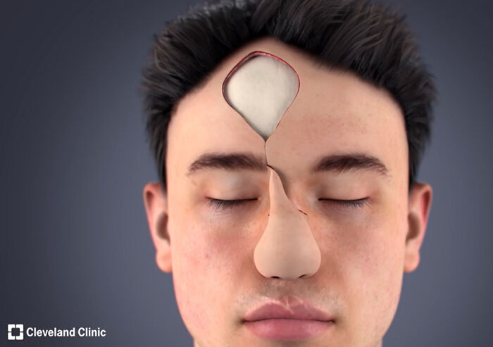 Before And After Of Man Who Received &ldquo;Amazing&rdquo; Nasal Reconstruction After Getting Mauled By Dog