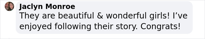 Dicephalus-Conjoined Twin Abby Hensel Of &ldquo;Abby & Brittany&rdquo; Is Married