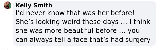 &ldquo;Shouldn&rsquo;t Have Done Anything&rdquo;: People React To Megan Fox&rsquo;s Long List Of Plastic Surgeries