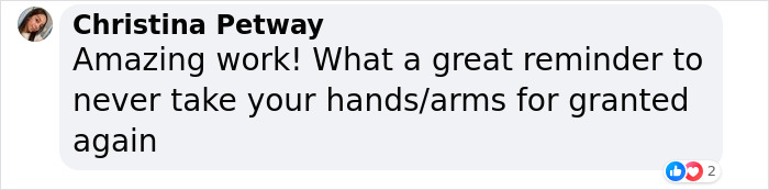 People Are Amazed By Limbless Makeup Influencer Who Creates Stunning Looks