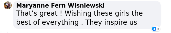Dicephalus-Conjoined Twin Abby Hensel Of &ldquo;Abby & Brittany&rdquo; Is Married