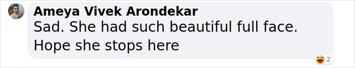 &ldquo;Shouldn&rsquo;t Have Done Anything&rdquo;: People React To Megan Fox&rsquo;s Long List Of Plastic Surgeries