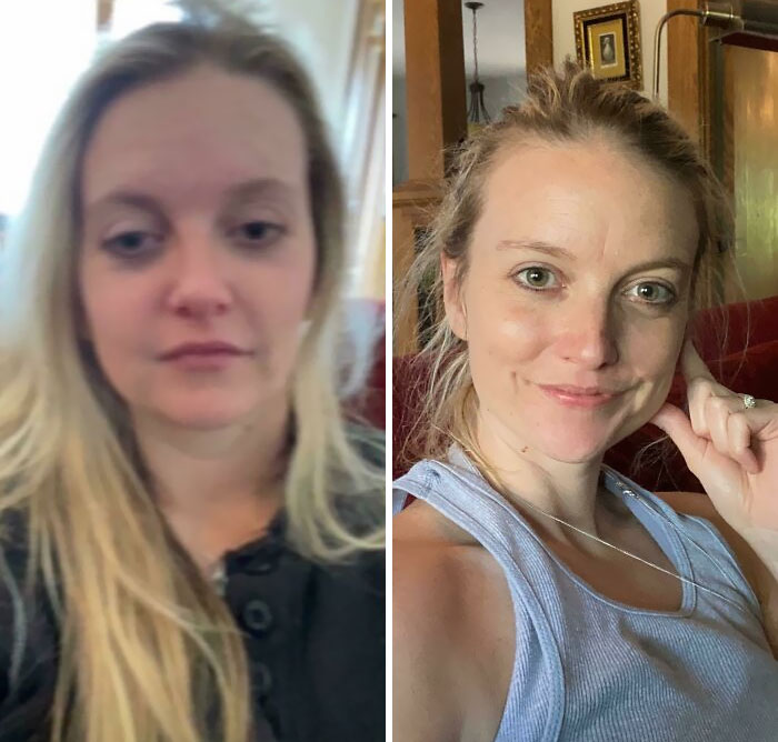 Before and after pictures of a woman showing positive changes after overcoming a*******n with improved health and appearance.