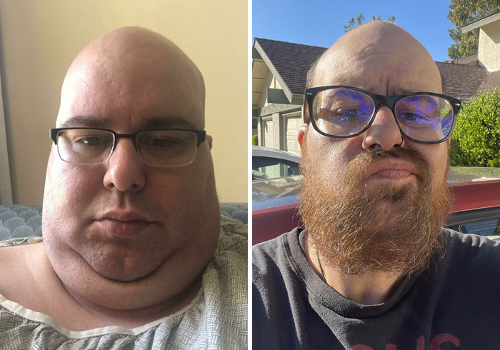 1 año libre de drogas y alcohol, y 90 kilos menos