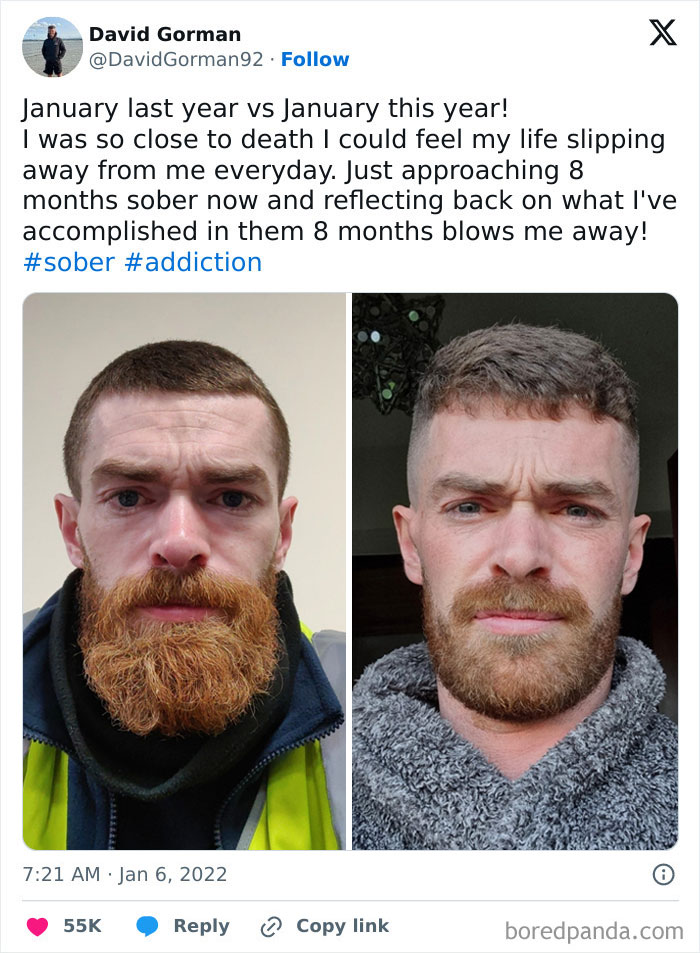 Side-by-side before and after pictures showing a man's transformation overcoming a*******n and achieving sobriety.