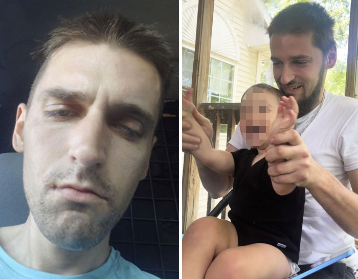 Before and after pictures showing a man overcoming a*******n, looking healthier and happy with a child outdoors.