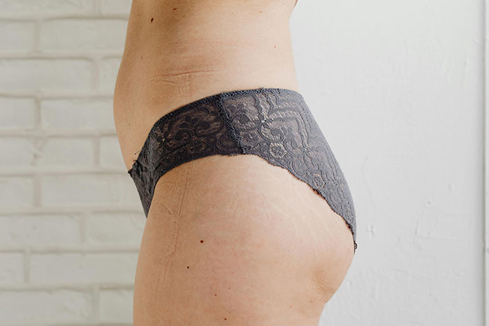 40 People Share The Weirdest Things About Their Bodies - 12