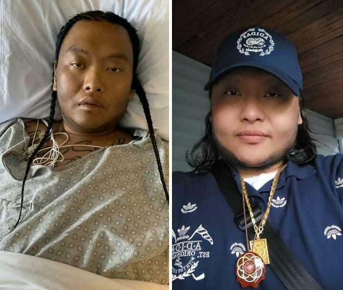 It's Been Nearly 4 Years Since I Was Diagnosed With Stage IV Cancer. As Of February 22nd of 2023, I'm Cancer-Free