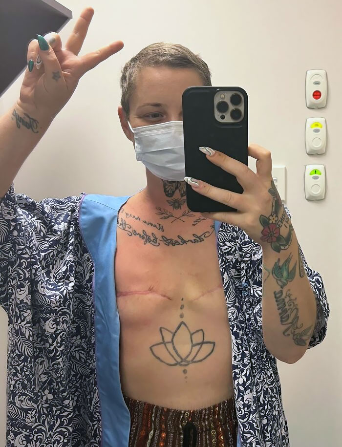 After 9 Months Of Cancer Treatment, Including 16 Rounds Of Chemo, 2 Surgeries, 16 Rounds Of Radiation And Multiple Complications, I Finally Finished Active Treatment For Breast Cancer