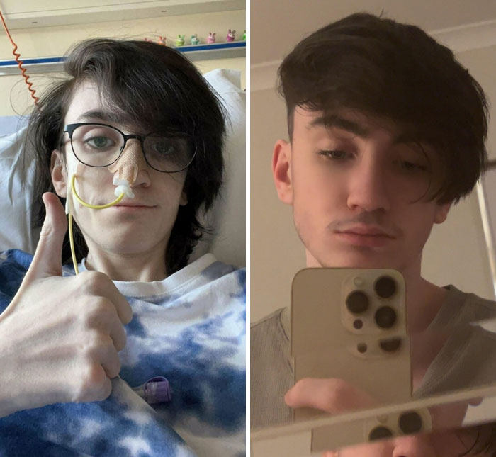 6 Months Ago I Was Rushed To Hospital At 32 Kg And Told I Would Be Dead In A Week. Today, I Have Been Discharged From Inpatient Care At 52 Kg And I Turn 18